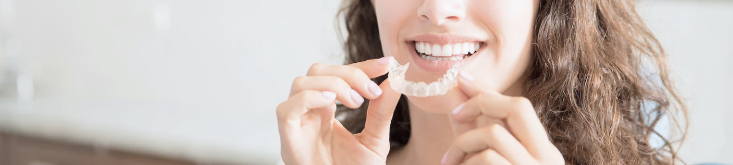 Исправление прикуса элайнерами