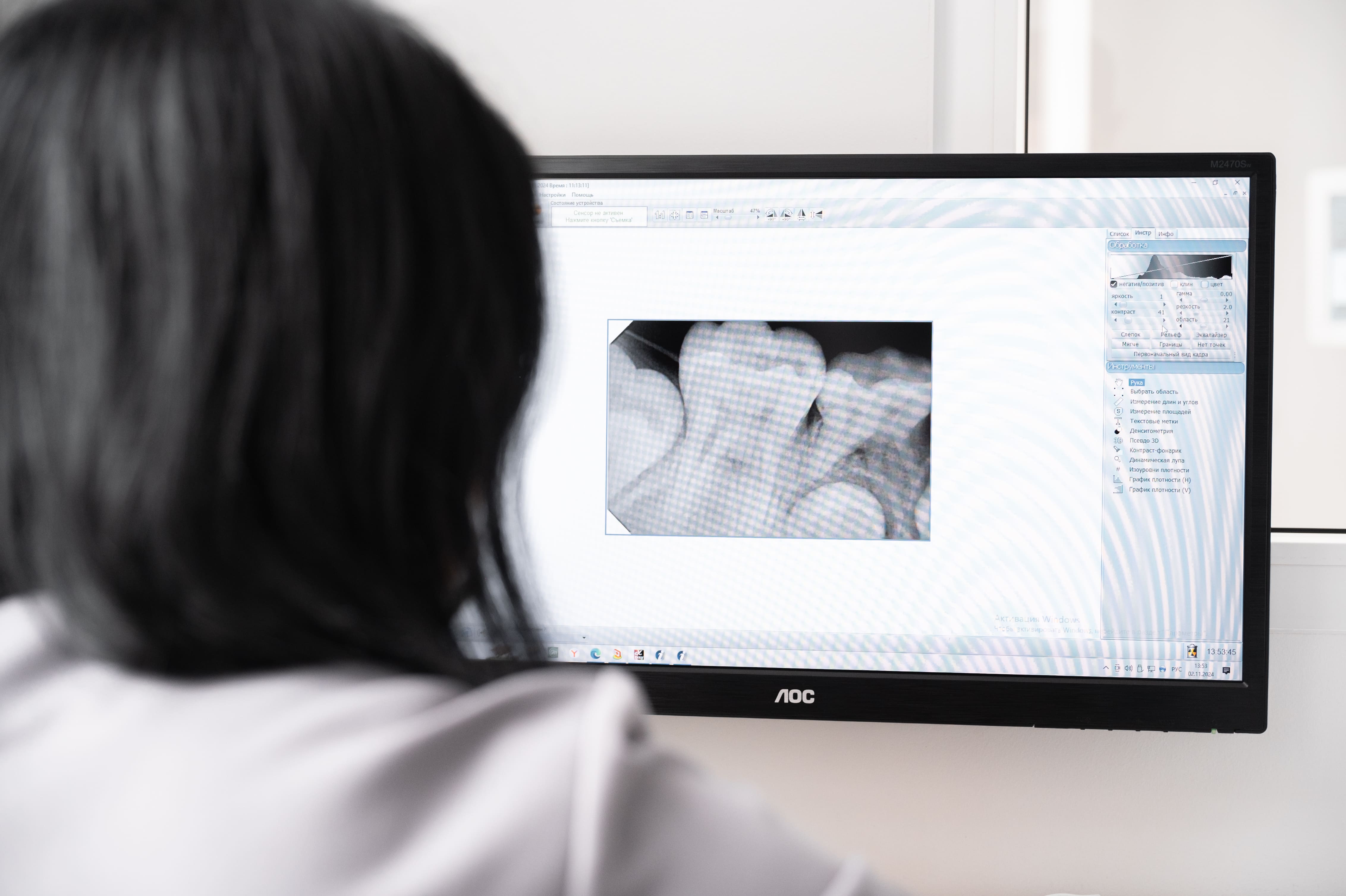 Компьютерная томография зубов