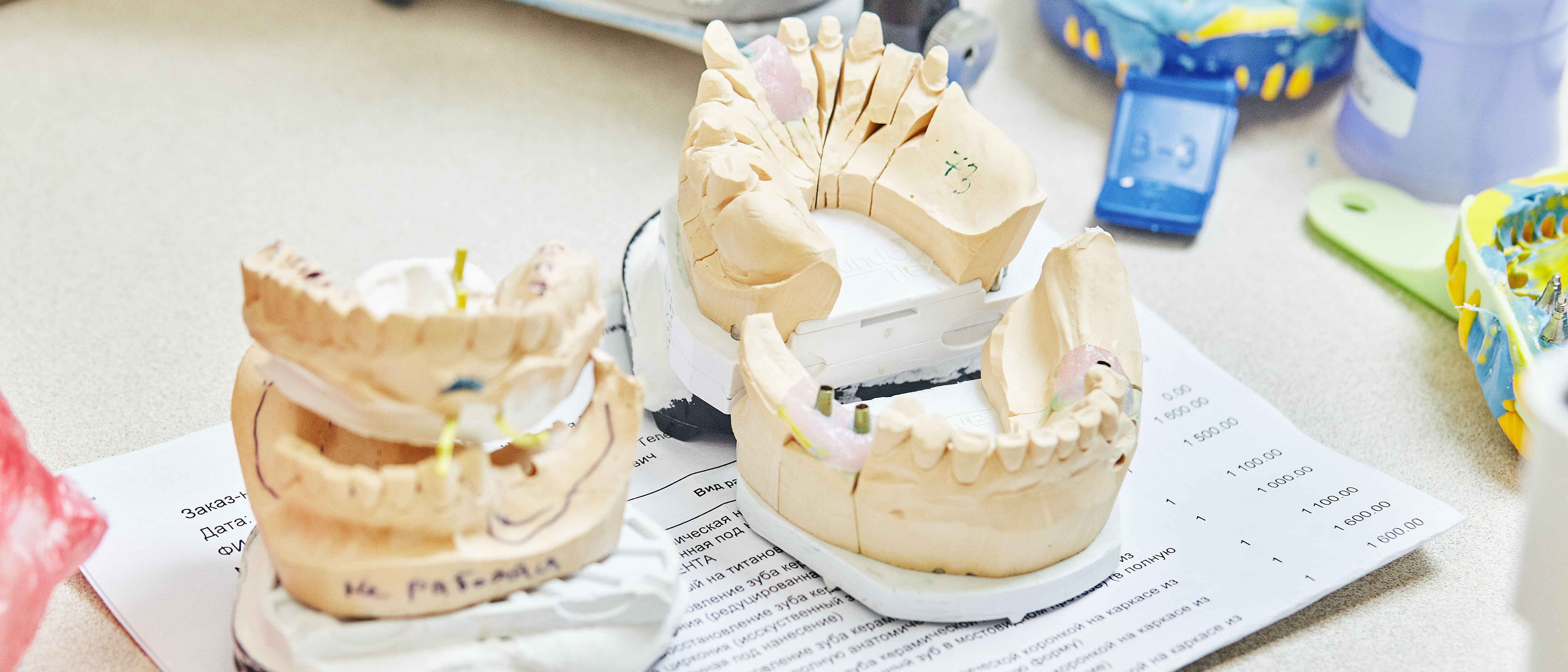 Протезирование на имплантах