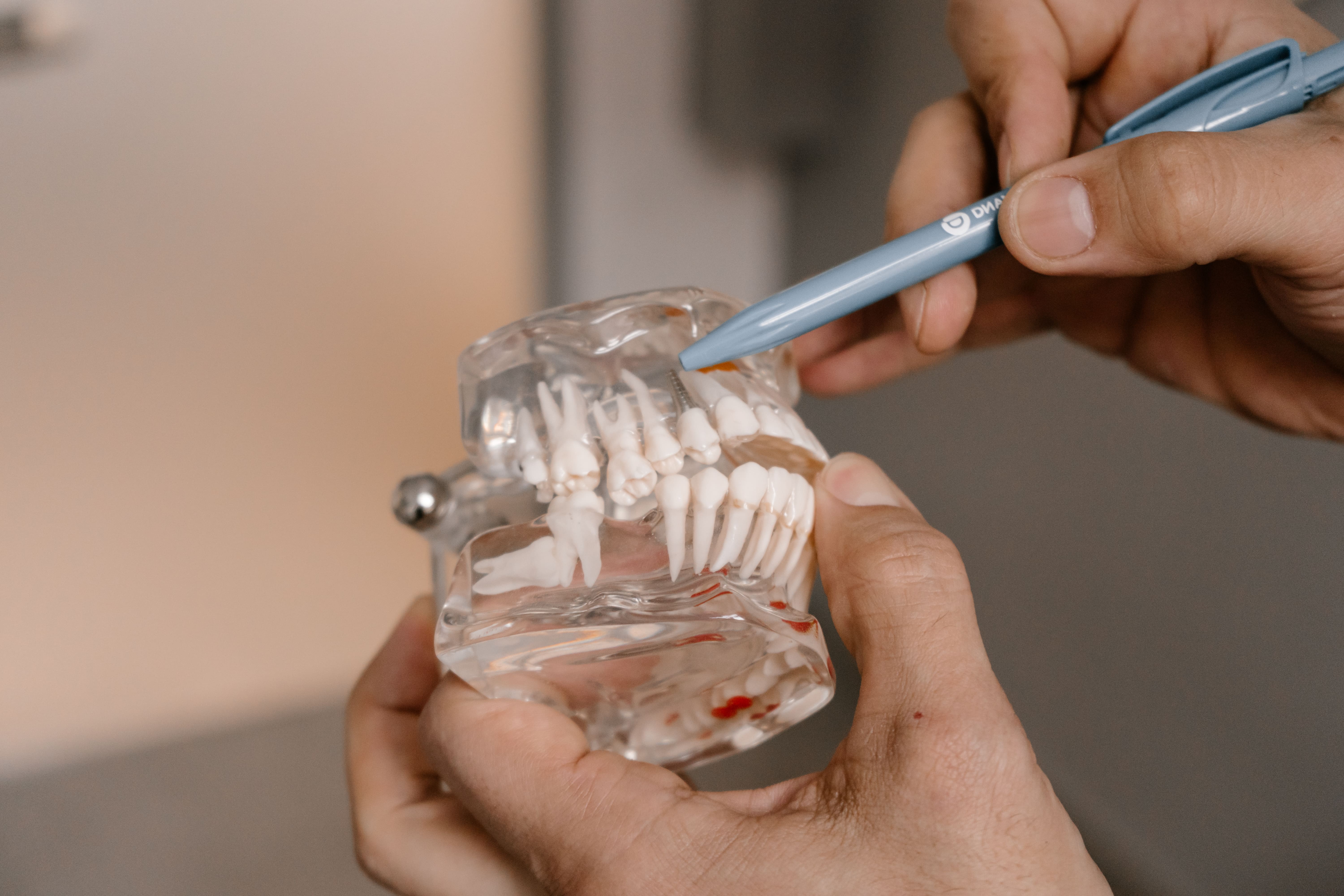 Костная пластика